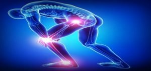 sciatica-Nerve-Dam465332 3