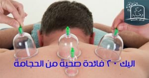 اليك 20 فائدة صحية من الحجامة 3
