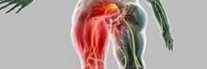 علاج-عرق-النسا-بالحجامة 3