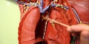 أثرالحجامة الطحال 3