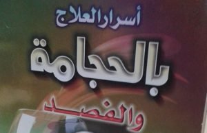 أسرار العلاج بالحجامة والفصد 0 3