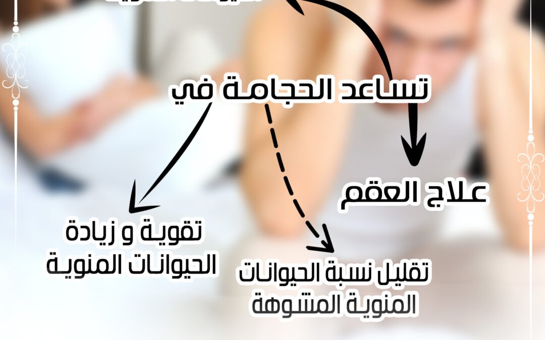 الحجامة تساعد على علاج العقم وتقليل نسبة الحيوانات المنوية المشوهة