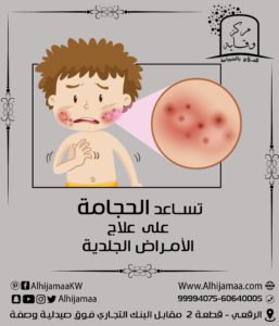 الحجامة تساعد في علاج المراض الجلدية 3