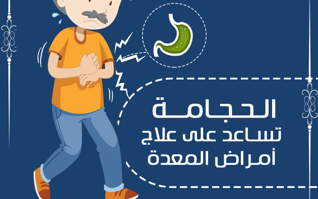 الحجامة تساعد على علاج أمراض المعدة و القولون