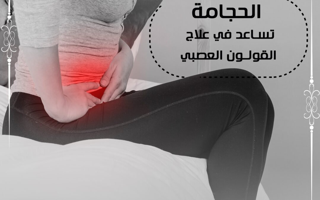 الحجامة تساعد في علاج القولون العصبي