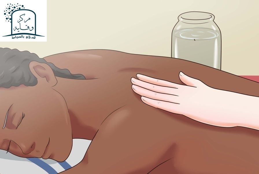 أضرار الحجامة للنساء